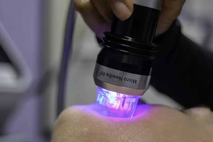 microneedling Groningen